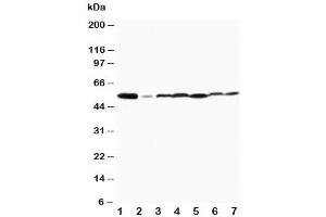 Western blot testing of MAPK8/9 antibody and Lane 1:  rat brain (MAPK8 / MAPK9 (Middle Region) 抗体)