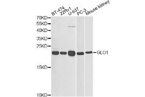 Western blot analysis of extracts of various cell lines, using GLO1 antibody (ABIN1872829) at 1:1000 dilution. (GLO1 抗体)