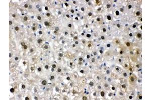 IHC testing of FFPE mouse liver with DDB1 antibody. (DDB1 抗体  (AA 1011-1140))