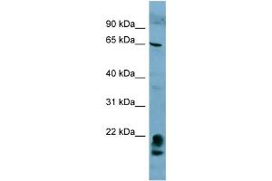 WB Suggested Anti-FAM134A  Antibody Titration: 0. (FAM134A 抗体  (N-Term))