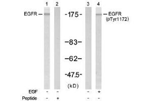 Image no. 1 for anti-Epidermal Growth Factor Receptor (EGFR) (Tyr1172) antibody (ABIN197448) (EGFR 抗体  (Tyr1172))