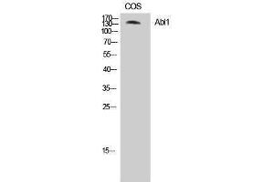 Western Blotting (WB) image for anti-C-Abl Oncogene 1, Non-Receptor tyrosine Kinase (ABL1) (Ser120), (Ser121) antibody (ABIN3183605) (ABL1 抗体  (Ser120, Ser121))
