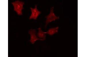 ABIN6275787 staining HepG2 cells by IF/ICC. (SRCIN1 抗体  (Internal Region))