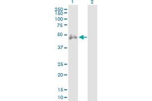 Western Blot analysis of CD2 expression in transfected 293T cell line by CD2 MaxPab polyclonal antibody. (CD2 抗体  (AA 1-351))