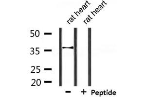 Western blot analysis of extracts from rat heart, using CACNG7 Antibody. (CACNG7 抗体  (Internal Region))