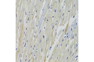 Immunohistochemistry of paraffin-embedded rat heart using AKT1S1 Antibody (ABIN1882365) at dilution of 1:100 (40x lens). (PRAS40 抗体)