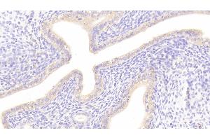 Detection of DKK1 in Rat Uterus Tissue using Polyclonal Antibody to Dickkopf Related Protein 1 (DKK1) (DKK1 抗体  (AA 36-260))