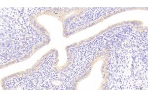 Detection of DKK1 in Rat Uterus Tissue using Polyclonal Antibody to Dickkopf Related Protein 1 (DKK1) (DKK1 抗体  (AA 36-260))