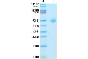 CD4 Protein (CD4) (AA 26-390) (His tag)