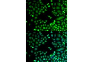 Immunofluorescence analysis of MCF-7 cells using RAD9A antibody. (RAD9A 抗体)