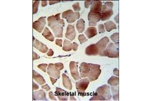 Immunohistochemistry (Paraffin-embedded Sections) (IHC (p)) image for anti-Protein Associated with Topoisomerase II Homolog 1 (PATL1) (AA 489-518), (C-Term) antibody (ABIN653753)
