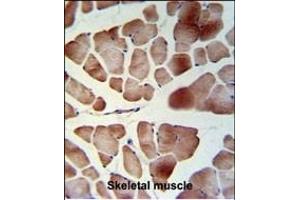 TL1 Antibody (C-term) (ABIN653753 and ABIN2843053) IHC analysis in formalin fixed and raffin embedded skeletal muscle followed by peroxidase conjugation of the secondary antibody and DAB staining. (PATL1 抗体  (C-Term))