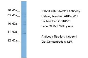 WB Suggested Anti-C1orf111  Antibody Titration: 0. (C1ORF111 抗体  (N-Term))