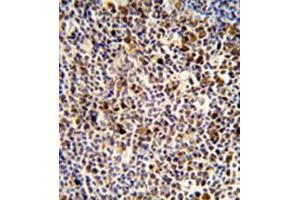 Immunohistochemistry (Paraffin-embedded Sections) (IHC (p)) image for anti-Killer Cell Immunoglobulin-Like Receptor, three Domains, Long Cytoplasmic Tail, 3 (KIR3DL3) (AA 138-167), (Middle Region) antibody (ABIN953083)