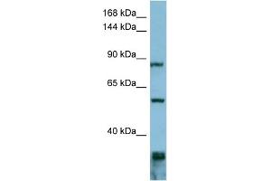WB Suggested Anti-EPS8  Antibody Titration: 0. (EPS8 抗体  (Middle Region))