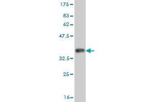 Western Blot detection against Immunogen (35. (ADH6 抗体  (AA 55-144))