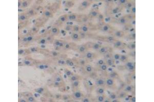Immunohistochemistry (IHC) image for anti-phosphorylase, Glycogen, Liver (PYGL) (AA 341-509) antibody (ABIN1173786)