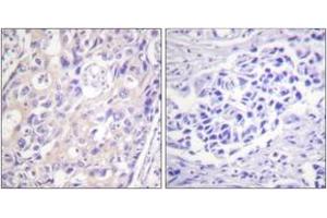 Immunohistochemistry (IHC) image for anti-Ribosomal Protein S6 Kinase, 90kDa, Polypeptide 3 (RPS6KA3) (AA 331-380), (pThr359) antibody (ABIN1531362)
