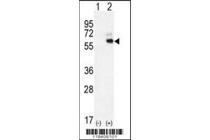 Western blot analysis of KNG1 using rabbit polyclonal KNG1 Antibody using 293 cell lysates (2 ug/lane) either nontransfected (Lane 1) or transiently transfected (Lane 2) with the KNG1 gene. (KNG1 抗体  (N-Term))