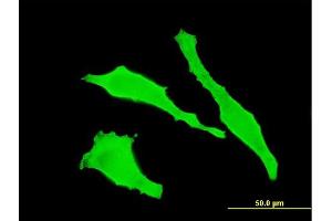 Immunofluorescence of monoclonal antibody to TGOLN2 on HeLa cell. (TGOLN2 抗体  (AA 229-327))