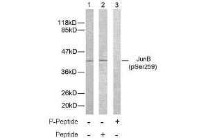 Image no. 2 for anti-Jun B Proto-Oncogene (JUNB) (pSer259) antibody (ABIN196658) (JunB 抗体  (pSer259))