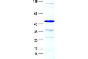 Western Blotting (WB) image for Kallikrein 1 (KLK1) protein (GST tag,His tag) (ABIN5505707)