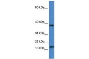Image no. 1 for anti-Vesicle-Associated Membrane Protein 1 (Synaptobrevin 1) (VAMP1) (AA 53-102) antibody (ABIN6747255) (VAMP1 抗体  (AA 53-102))