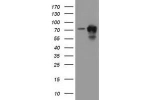 Western Blotting (WB) image for anti-Pseudouridylate Synthase 7 Homolog (PUS7) antibody (ABIN1500515) (PUS7 抗体)
