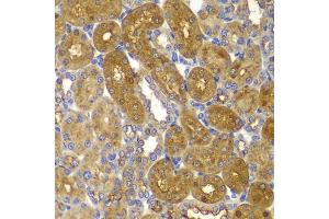 Immunohistochemistry of paraffin-embedded rat kidney using PRKAB1 antibody (ABIN5995401) at dilution of 1/100 (40x lens). (PRKAB1 抗体)