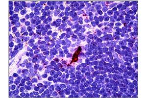 Immunohistochemistry (IHC) image for anti-Interleukin-27 subunit beta (IL-27b) antibody (ABIN781990) (EBI3 抗体)