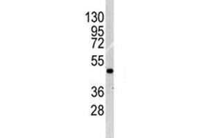 Western blot analysis of ILK1 antibody and NCI-H460 lysate. (ILK 抗体  (AA 151-180))