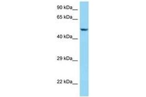 Image no. 1 for anti-Sarcalumenin (SRL) (AA 263-312) antibody (ABIN6748104) (Sarcalumenin 抗体  (AA 263-312))