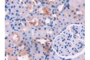 Immunohistochemistry (IHC) image for anti-Lecithin-Cholesterol Acyltransferase (LCAT) (AA 41-210) antibody (ABIN7436696)