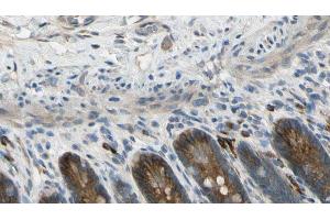 ABIN6274601 at 1/100 staining Mouse intestine tissue by IHC-P. (CDH22 抗体  (N-Term))