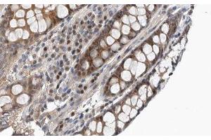ABIN6277238 at 1/100 staining Rat colon tissue by IHC-P. (TIM3 抗体  (C-Term))