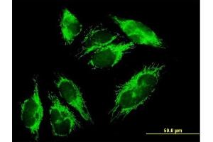 Immunofluorescence of purified MaxPab antibody to HIBADH on HepG2 cell. (HIBADH 抗体  (AA 1-336))