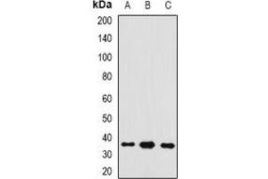 Western blot analysis of GAS2 expression in SW620 (A), mouse liver (B), mouse kidney (C) whole cell lysates.
