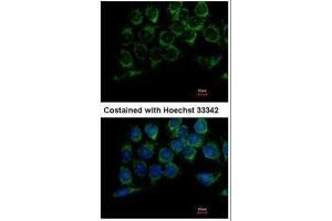 ICC/IF Image Immunofluorescence analysis of methanol-fixed Hep3B, using DLD, antibody at 1:100 dilution. (DLD 抗体)