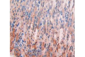 Used in DAB staining on fromalin fixed paraffin- embedded stomach tissue (GPC4 抗体  (AA 220-426))