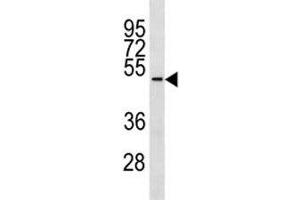 TUBD1 antibody western blot analysis in ZR-75-1 lysate. (TUBD1 抗体  (AA 366-392))