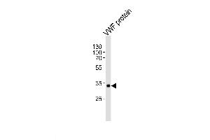 Lane 1: VWF protein, probed with VWF (907CT12. (VWF 抗体)