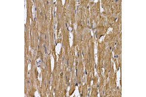 Immunohistochemistry (IHC) image for anti-Signal Transducer and Activator of Transcription 3 (Acute-Phase Response Factor) (STAT3) (AA 640-770) antibody (ABIN6148568)