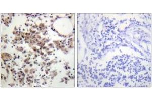 Immunohistochemistry analysis of paraffin-embedded human lymph node, using SYK (Phospho-Tyr323) Antibody. (SYK 抗体  (pTyr323))