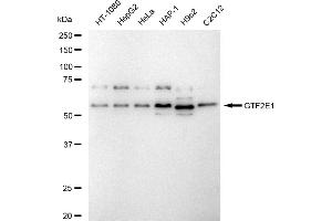 Western blotting analysis using GTF2E1 antibody (ABIN7798707).
