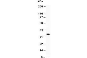 Western blot testing of KLF6 antibody and recombinant human protein (0. (KLF6 抗体  (AA 38-205))