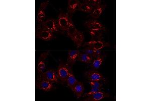 Confocal immunofluorescence analysis of Hela cells using GM130 antibody (ABIN6129789, ABIN6141264, ABIN6141265 and ABIN6220979) at dilution of 1:400. (Golgin A2 (GOLGA2) (AA 20-300) 抗体)