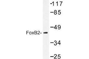 Image no. 1 for anti-Forkhead Box B2 (FOXB2) antibody (ABIN317907) (FOXB2 抗体)