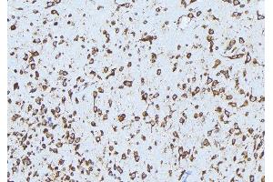 ABIN6279159 at 1/100 staining Mouse brain tissue by IHC-P. (ABCA3 抗体  (Internal Region))