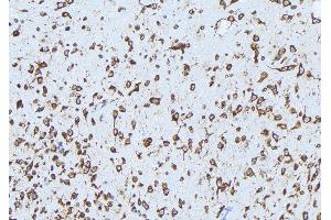 ABIN6279159 at 1/100 staining Mouse brain tissue by IHC-P. (ABCA3 抗体  (Internal Region))