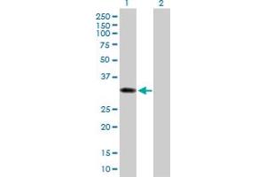 Western Blot analysis of SULT1B1 expression in transfected 293T cell line by SULT1B1 MaxPab polyclonal antibody. (SULT1B1 抗体  (AA 1-296))